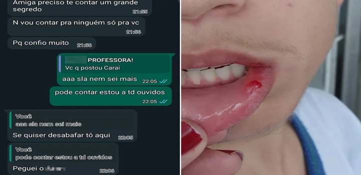 Professora é Demitida Após Assumir Ter Beijado Aluno Em Praia Grande Sp